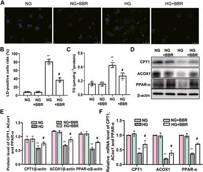 Berberine Reduces Lipid Accumulation by Promoting Fatty Acid Oxidation in Renal Tubular Epithelial Cells of the Diabetic Kidney